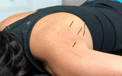 can dry needling cause more pain